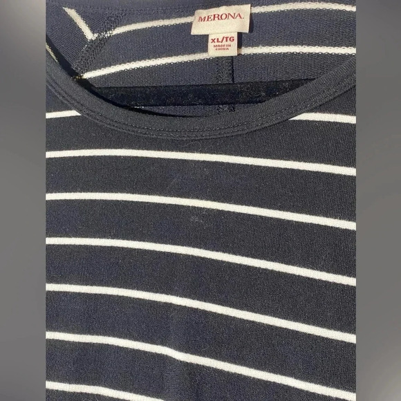 Striped Black and White Dress - Picture 3 of 3